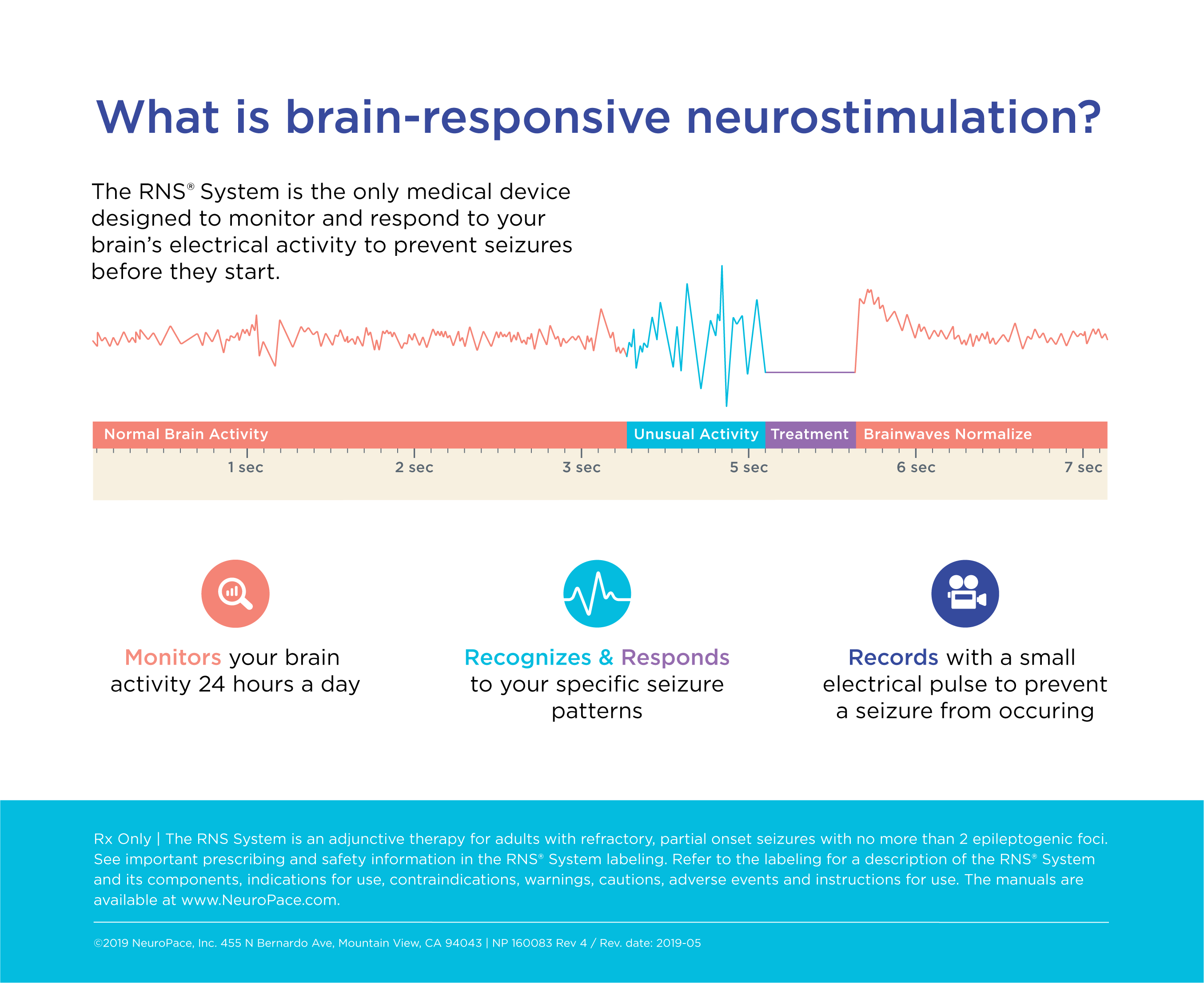 neurostimulation infographics