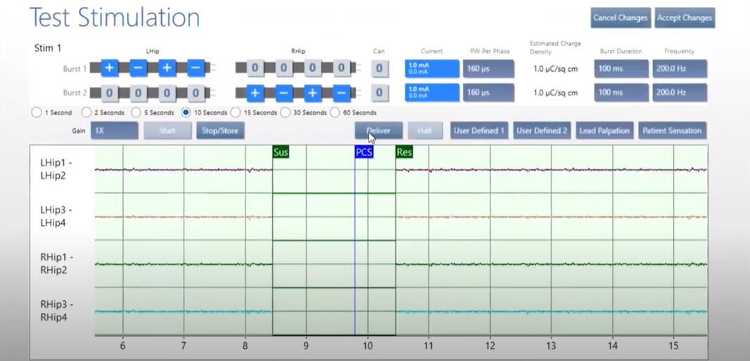 test stimulation chart