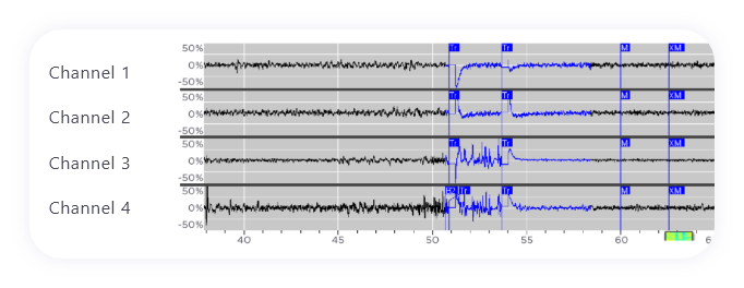 eeg data