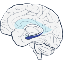 NeuroPace mesial temporal onset case study