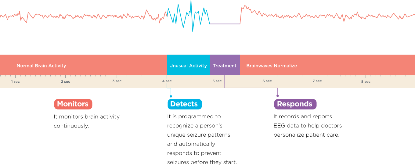 How the RNS System Works