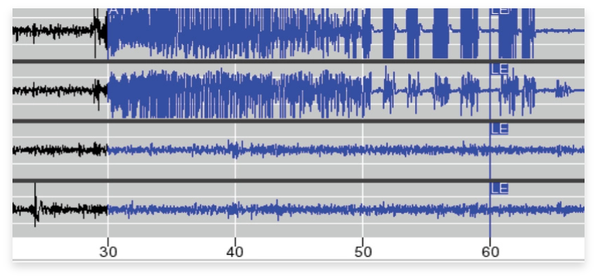 Sample electrographic chart